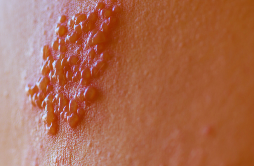 El Consejo General de Enfermería incluye las vacunas frente al Herpes Zóster y el VRS en su guía de vacunación